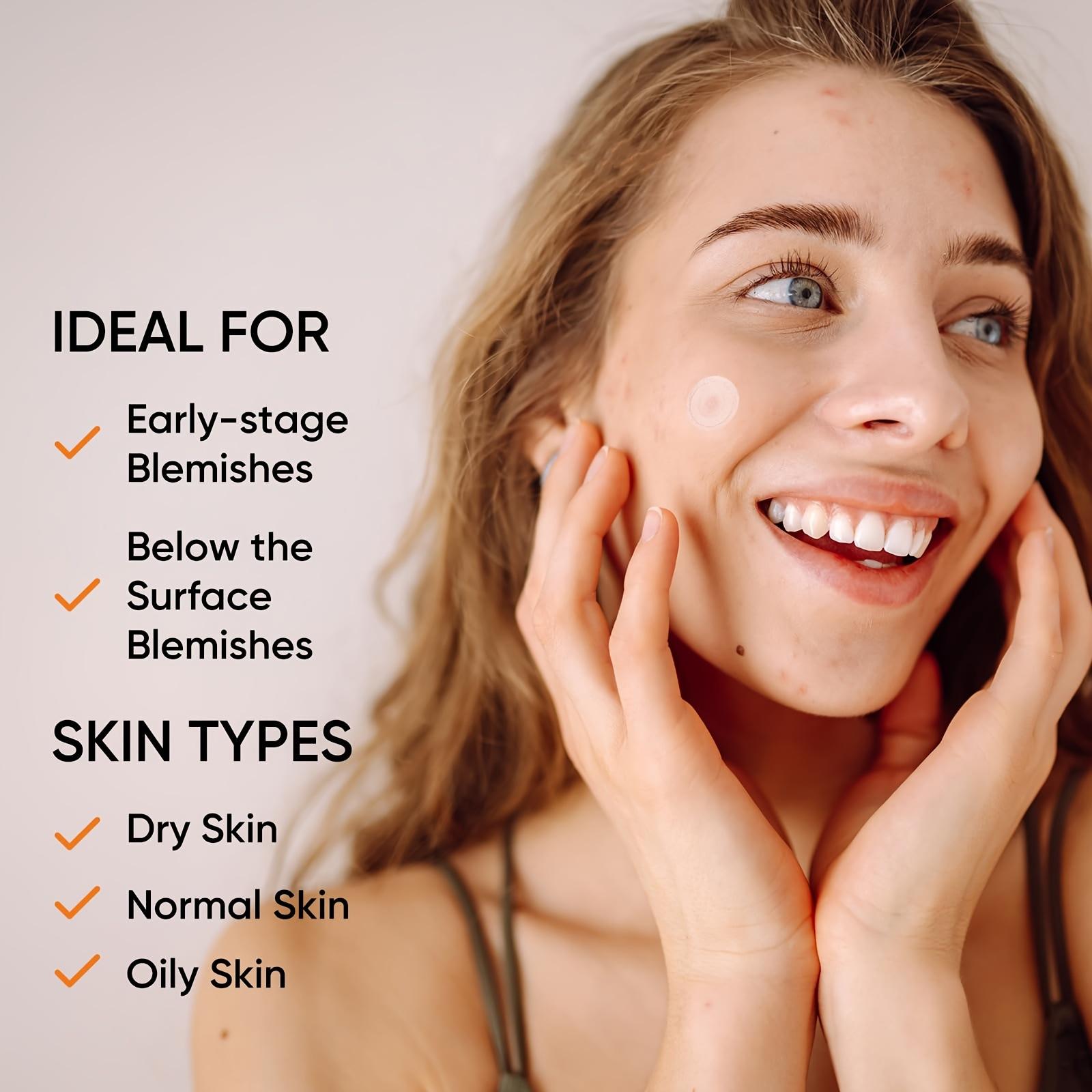 Büyük Hidrojel Akne Bantları X - Xl Skincare incelemesi ve fiyatı