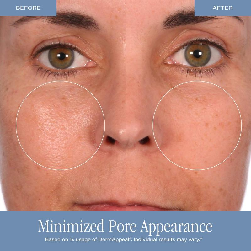 Kozmetik DermAppeal Mikroderma - Skincare Exfoliating incelemesi ve fiyatı